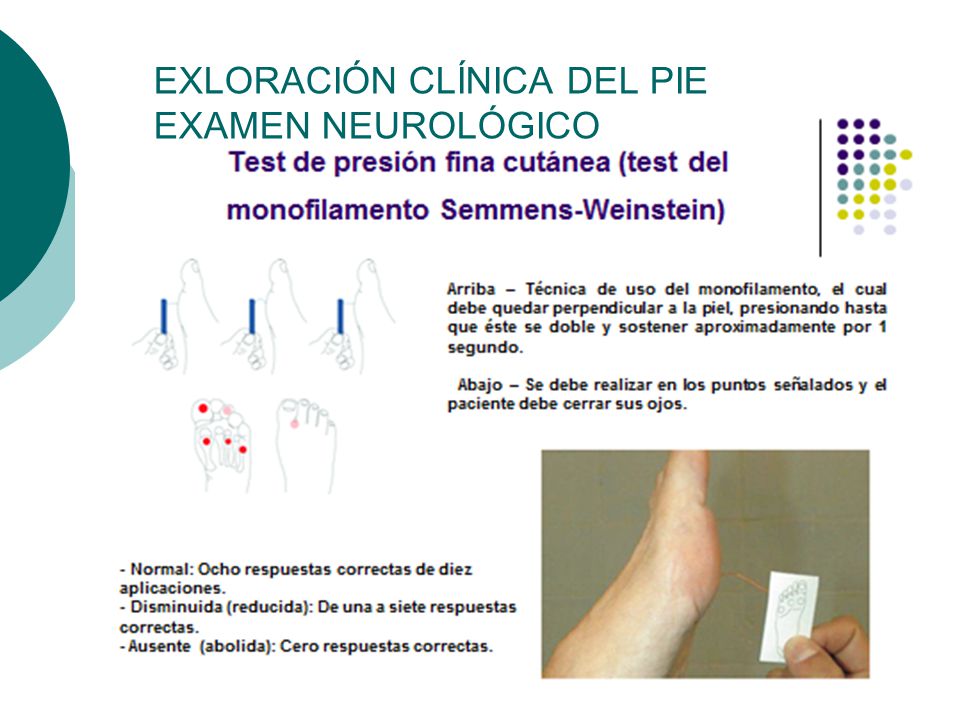 examen de monofilamento diabetes